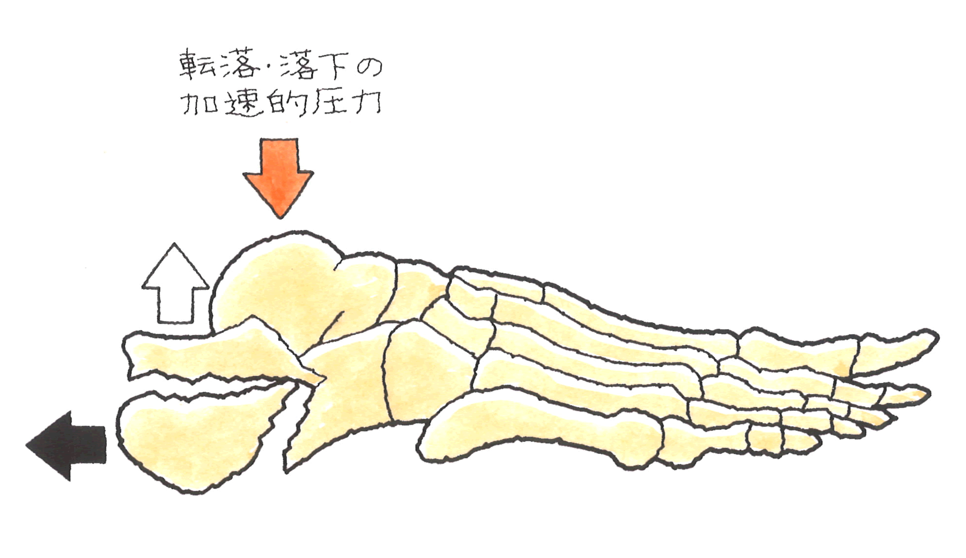 図５　加速的圧力.gif